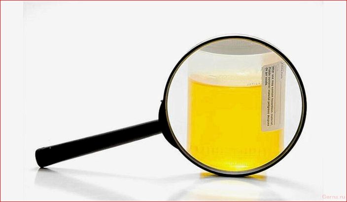 benefit, harm, urine therapy, helps, opinion