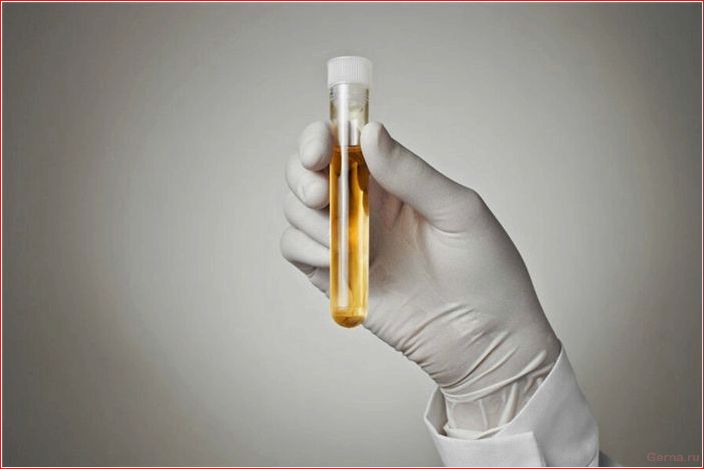 benefit, harm, urine therapy, helps, opinion
