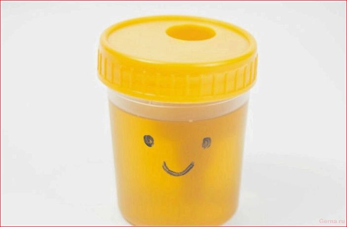 benefit, harm, urine therapy, helps, opinion