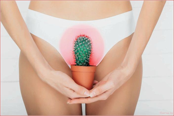Recurrent, genital, herpes, cause, treatment